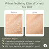 Before and after comparison of skin condition with text about effectiveness.