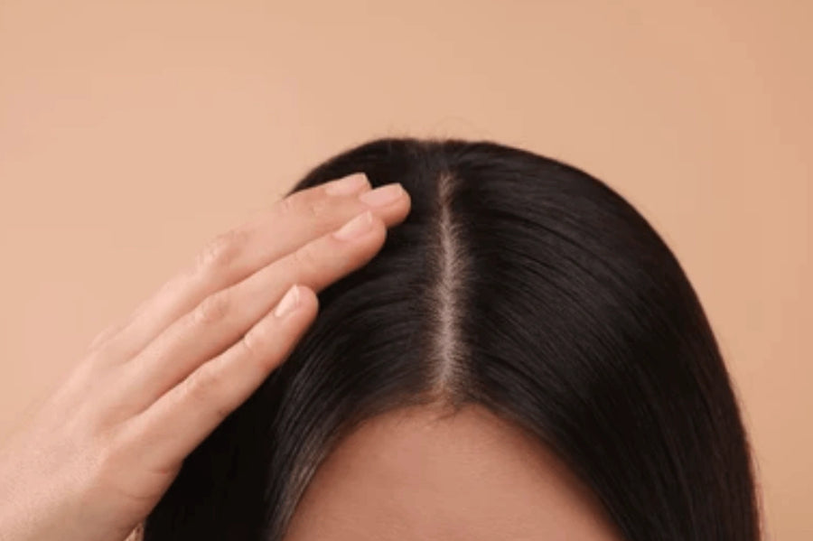 Dry, Flaky & Itchy Scalp
