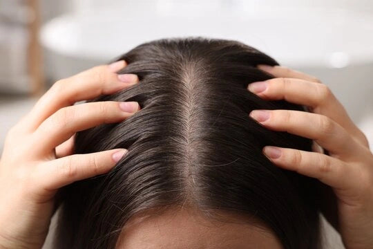 Dry Itchy Scalp