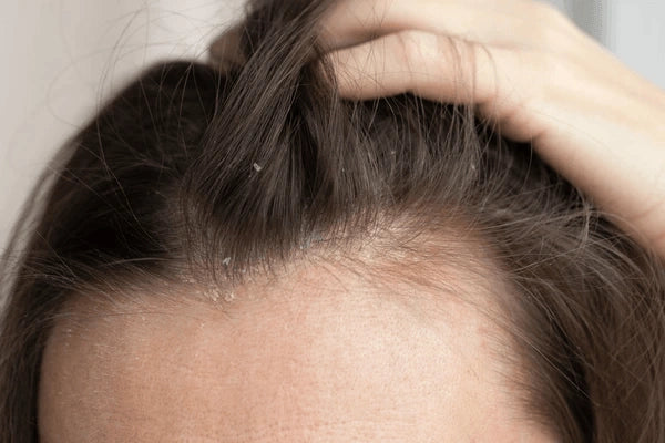 HAIR DENSITY Essentials